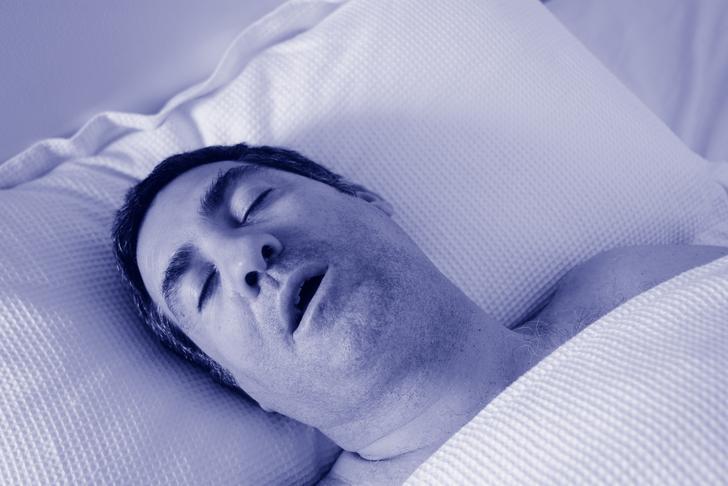 sleep apnea
