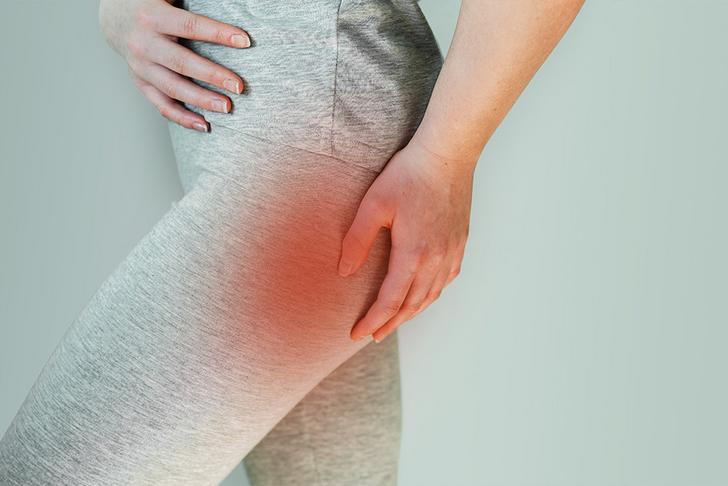 piriformis syndrome symptoms