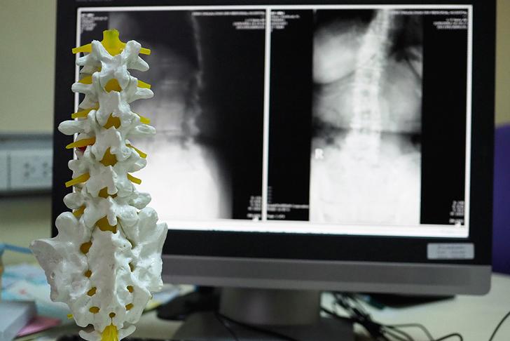 spinal stenosis treatments