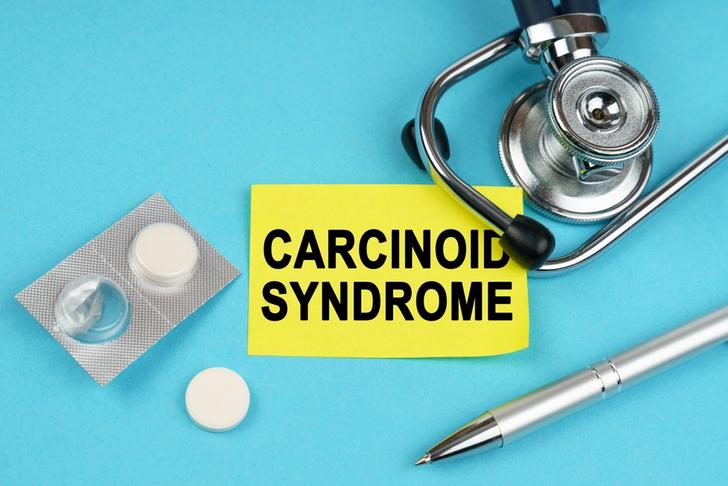 carcinoid syndrome-hot-flashes